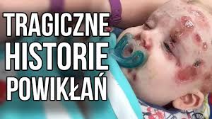 Tragiczne historie powiklan